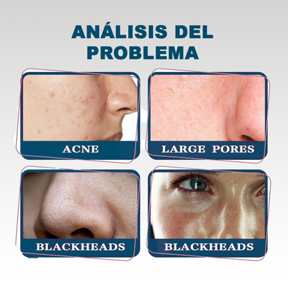 REVOLUTIONARY SOLUTION FOR PERFECT SKIN