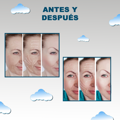 REVOLUTIONARY SOLUTION FOR PERFECT SKIN